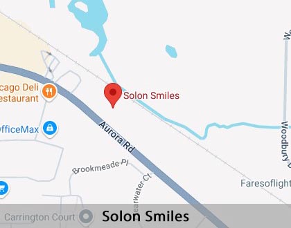 Map image for Emergency Dentist in Solon, OH